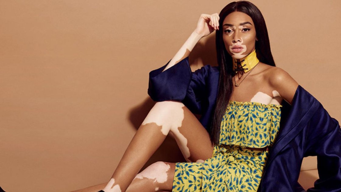 Winnie Harlow's Inspiring Message Of Self-confidence And Self-love