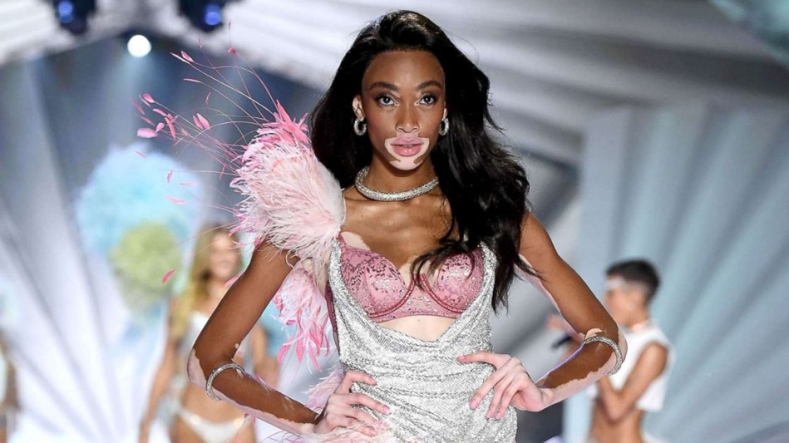 Winnie Harlow's Inspiring Message Of Self-confidence And Self-love