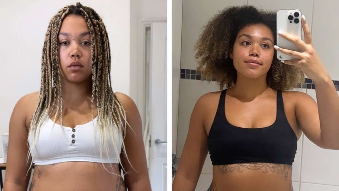 Ruby Barker's Health Transformation: She Says, Happy To Be Alive!