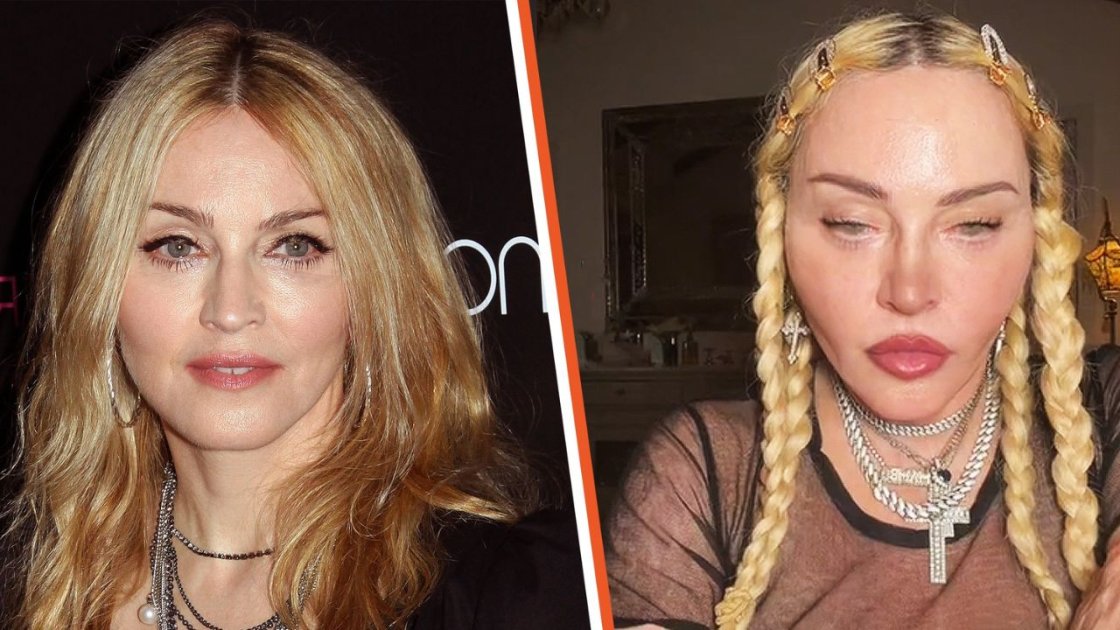 Shocking Transformation: See Madonna's Unrecognizable Look!